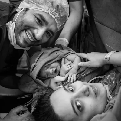 The first family photo, taken moments after birth. This image captures the overwhelming joy and relief of the new parents as they meet their baby for the first time, a priceless memory from our birth photography service.