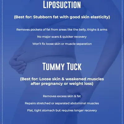 Here is a clear breakdown of when to choose liposuction versus a tummy tuck. Liposuction is ideal for stubborn fat with good skin elasticity, while a tummy tuck addresses loose skin and weakened muscles.