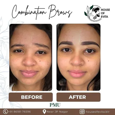 A stunning Combination Brow transformation. I gave her sparse, uneven brows a complete makeover with a defined arch and fuller shape, perfectly complementing her features.