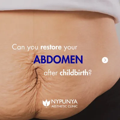 Can you restore your abdomen after childbirth? Yes. This series explains the changes that happen to your body and how body contouring treatments can help you regain confidence.