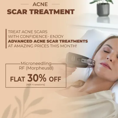 Our advanced acne scar treatments, like Microneedling RF (Morpheus8), are designed to remodel and resurface the skin. This technology effectively reduces the depth of scars and improves overall skin texture.