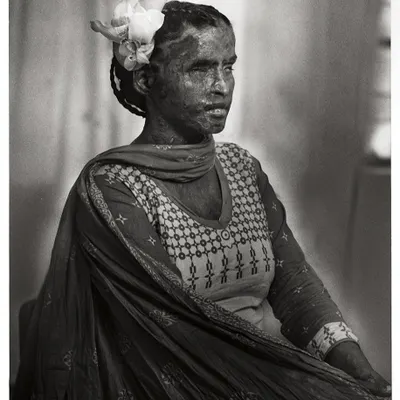 This is Rupali. Her strength and spirit are a testament to the true meaning of beauty. Working with the Sheroes has been a foundational part of my journey.