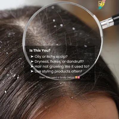 This magnified view shows the reality of a scalp suffering from dryness, flakes, and product buildup. If you have an oily or itchy scalp and notice your hair isn't growing as it used to, it's a clear sign that you need a professional scalp detox to reset its health.