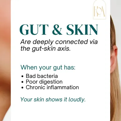 Your gut and skin are deeply connected. When your gut has bad bacteria, poor digestion, or chronic inflammation, your skin often shows it loudly through acne, redness, and other persistent issues.