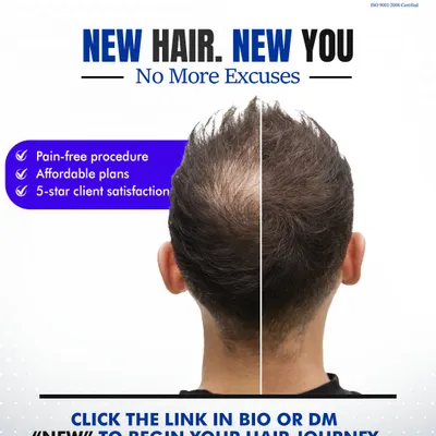 New Hair, New You. No more excuses. My procedures are pain-free, with affordable plans and a history of 5-star client satisfaction. Your journey starts here.