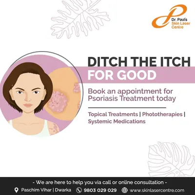 Psoriasis symptoms like itching and flaking can be relentless. I offer several paths to relief, including topical treatments, advanced phototherapies, and systemic medications to help you manage the condition effectively and "ditch the itch for good."
