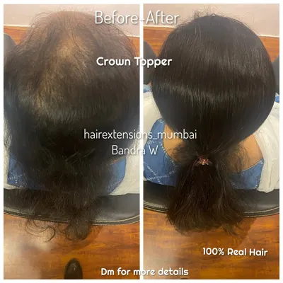 A before and after comparison showing a client with a crown topper. The piece effectively covers thinning on top and is styled into a neat ponytail, showing how it integrates with natural hair.