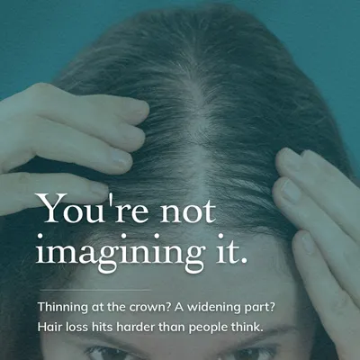 "You're not imagining it." This image speaks directly to women experiencing hair loss, such as a widening part or thinning at the crown. We understand these concerns and offer expert-led treatments designed for you.