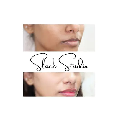 This client received my Korean Glass Skin treatment to address uneven skin tone and achieve a brighter complexion. The after photo shows a visible reduction in dullness and a more luminous, healthy skin surface.