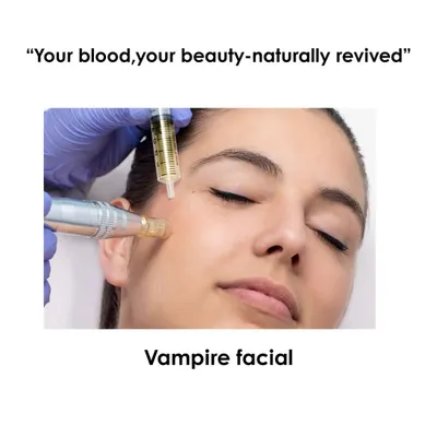 The Vampire Facial uses your own blood's healing power to rejuvenate your skin. This image shows the application of PRP with a microneedling device, which helps the growth factors penetrate deeply to stimulate collagen and repair the skin from within.