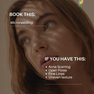 For concerns like acne scarring, open pores, and uneven texture, Microneedling is a highly effective treatment. It creates micro-injuries in the skin to trigger the body's natural collagen and elastin production, resulting in a smoother surface.