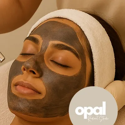Here is a client prepared for our Carbon Q-Switch Facial. The carbon mask acts as a target for the laser, helping to deeply cleanse the pores and exfoliate the skin for a refreshed and smooth finish.