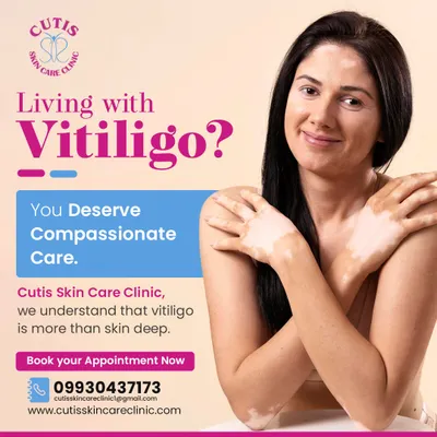Living with vitiligo requires compassionate care, not just treatment. We understand that vitiligo is more than skin deep and combine advanced solutions with empathy to restore confidence and support your skin health journey.