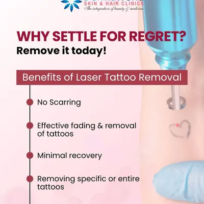 Do you have a tattoo that no longer represents you? We believe you shouldn't have to live with regret. Our laser tattoo removal service is a safe and effective way to clear your skin, with benefits like no scarring and minimal recovery time, so you can move forward with confidence.