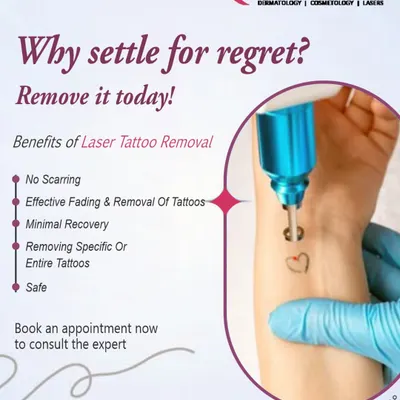 This chart details the primary benefits of undergoing laser tattoo removal at my clinic. The procedure is designed to be safe, minimize scarring, and effectively fade or completely remove unwanted tattoos with minimal recovery time.