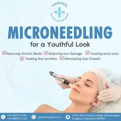 This graphic explains the benefits of microneedling, a procedure I use to treat acne scars, fine wrinkles, and even stimulate hair growth. By creating micro-injuries, it stimulates the skin's natural collagen production for a smoother, more youthful appearance.