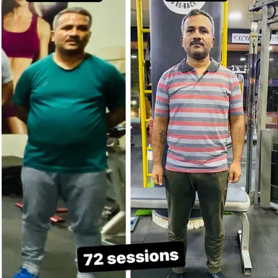 An incredible change achieved over 72 personal training sessions. This client's dedication to both his workouts and diet plan led to this amazing and sustainable body transformation.