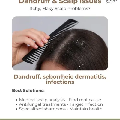 An itchy, flaky scalp is more than just an annoyance; it can be a sign of dandruff, seborrheic dermatitis, or an infection. We find the root cause through a medical scalp analysis and provide targeted antifungal treatments and specialized shampoos.