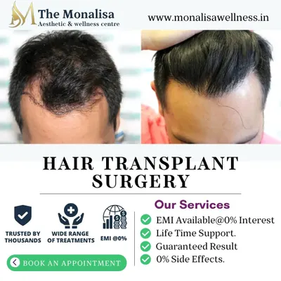 This before and after comparison showcases the high-density results we achieve with our hair transplant surgery. We focus on restoring a natural hairline that complements your features.