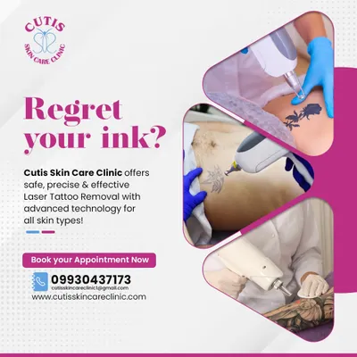 If you regret your ink, we can help you start fresh. This collage shows our laser tattoo removal process, which is safe and precise for all skin types. We use advanced technology to break down the ink and restore your skin's natural appearance.