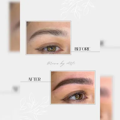 This before and after comparison clearly demonstrates the transformative effect of our brow service. We took a sparser brow and created a fuller, more defined arch that beautifully frames the eye.