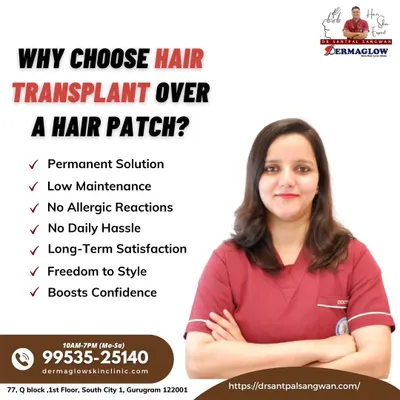 This graphic outlines the key advantages of choosing a permanent hair transplant over a temporary hair patch. A transplant offers a low-maintenance, long-term solution with no daily hassle or risk of allergic reactions.