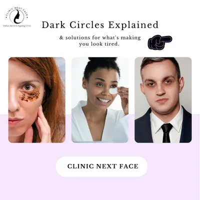 Dark circles can make you look tired even when you're not. We've explained the different causes and our targeted solutions to help you look refreshed.