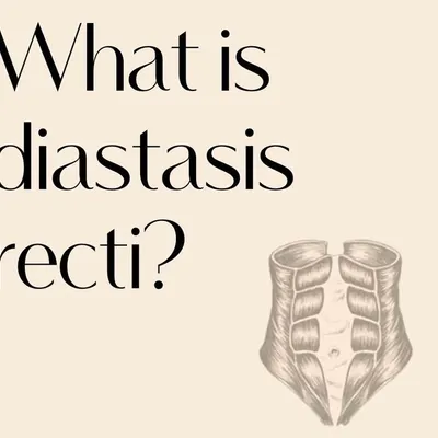Let's talk about Diastasis Recti. This is the first part of an informational series explaining what it is. Knowledge is the first step to healing.