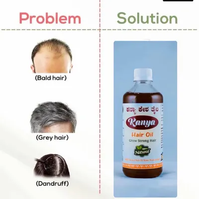 My Kanya Hair Oil is a single solution for multiple common hair problems. It's formulated to address hair loss, premature greying, and dandruff by nourishing the scalp with essential Ayurvedic ingredients.