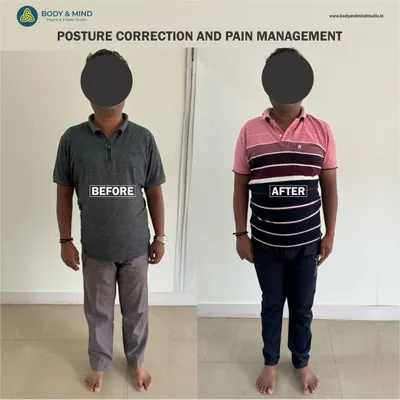 This before-and-after comparison shows the power of posture correction. By strengthening the core and realigning the spine, this client not only improved his stance but also alleviated the chronic pain associated with his previous posture.