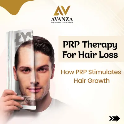 This image introduces our PRP Therapy for hair loss. It is a cutting-edge, non-surgical treatment that uses the healing power of your own blood to stimulate natural hair growth.