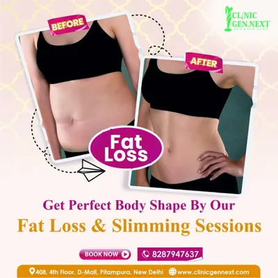 This before and after photo shows a real patient's journey with my fat loss and slimming session. You can see the significant reduction in stubborn belly fat, achieving a more contoured and defined body shape. This is the kind of result possible with CryoCool sculpting for targeted fat reduction.