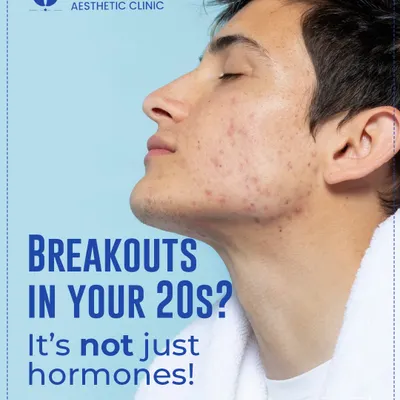 Still dealing with breakouts in your 20s and beyond? It's often not just 'teen acne'. Adult acne can be triggered by hormonal shifts, stress, and using the wrong products for your skin type.