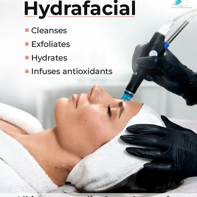 The authentic HydraFacial is an all-in-one medical-grade session. It deeply cleanses, exfoliates dead skin, hydrates with nourishing serums, and infuses protective antioxidants for a comprehensive skin reset.