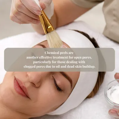 Chemical peels are a highly effective treatment for open and clogged pores caused by oil and dead skin buildup.