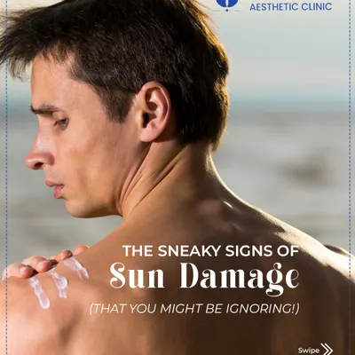 Many people are ignoring the sneaky signs of sun damage. It's not just about sunburns; it's about the gradual appearance of wrinkles, pigmentation, and rough skin.