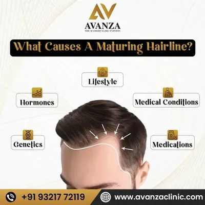 A maturing hairline is influenced by multiple factors. This graphic illustrates the primary causes we investigate during a consultation, including genetics, hormones, lifestyle, medical conditions, and medications.