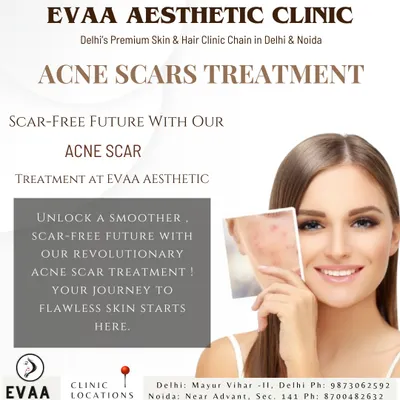 An introduction to our revolutionary acne scar treatments, designed to give you a smoother, scar-free future. We focus on creating flawless skin by addressing the texture and pigmentation left by old breakouts.