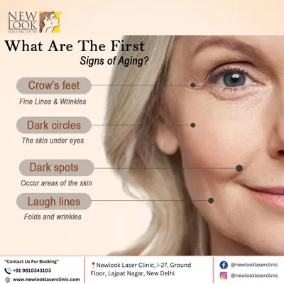 A helpful guide to the first signs of aging we commonly see and treat. Recognizing issues like crow's feet, dark circles, and laugh lines early allows for more effective intervention.