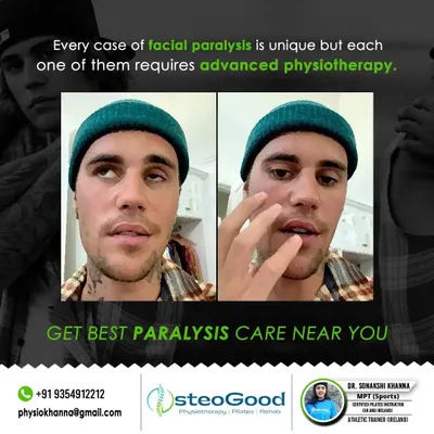 Understanding your condition is the first step to recovery. This graphic explains how advanced physiotherapy can effectively treat facial paralysis by targeting specific nerve and muscle groups to restore function and expression.