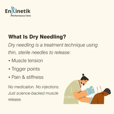 What is Dry Needling? It is a modern treatment technique that uses thin, sterile needles to release muscle tension, trigger points, and stiffness. There is no medication injected; it is a science-backed method for targeted muscle release.