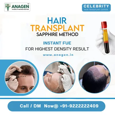 We use the Sapphire method and Instant FUE to achieve the highest density results. This combination allows for precise, scar free implantation and better graft survival, giving you a fuller, more natural look.