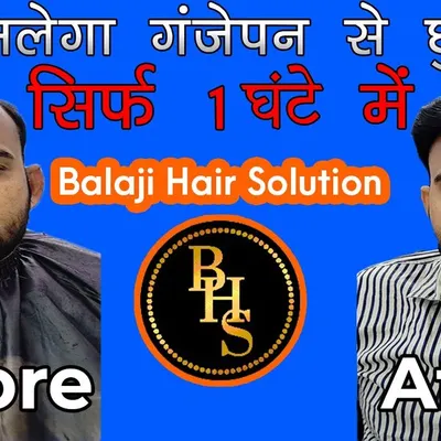 Dekhiye ye kamaal ka transformation. With our expert hair patch service, you can get freedom from baldness, or 'ganjepan se chhutkara', in just about an hour. We provide a new look and renewed confidence.