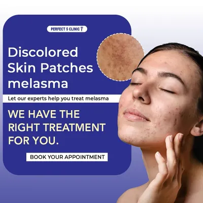 If you are struggling with discolored skin patches or melasma, our experts can help. We provide tailored treatments to address hyperpigmentation and help you on your journey to clear, even-toned skin.