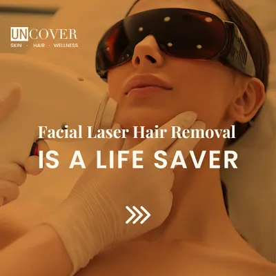 Facial laser hair removal is a true lifesaver. It saves time, prevents the pain of waxing, and gives you smooth skin so your makeup sits better. It is a game changer for your daily routine.