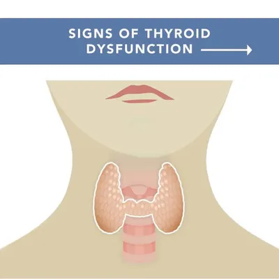 The thyroid gland is a master regulator of your metabolism, fertility, and energy. Understanding the signs of thyroid dysfunction is the first step toward seeking a proper diagnosis and creating a plan to restore its function.