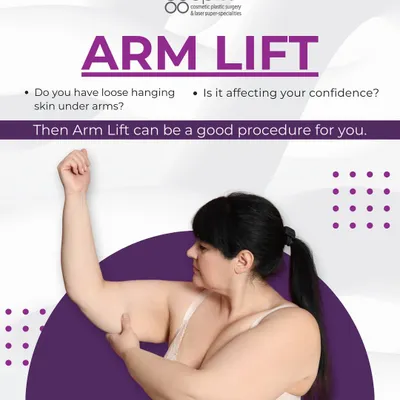 If you are bothered by loose, hanging skin under your arms, an arm lift, or brachioplasty, can be an excellent solution. This procedure is specifically designed to tighten and tone the upper arms for a more sculpted appearance.