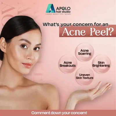 What is your main skin concern? This graphic breaks down how a professional Acne Peel can target specific issues, whether it's persistent breakouts, leftover acne scarring, uneven texture, or a desire for overall skin brightening.