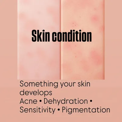 Understanding the difference between your skin type and your skin condition is key. Your type is what you're born with, but your condition (like acne or dehydration) can change.