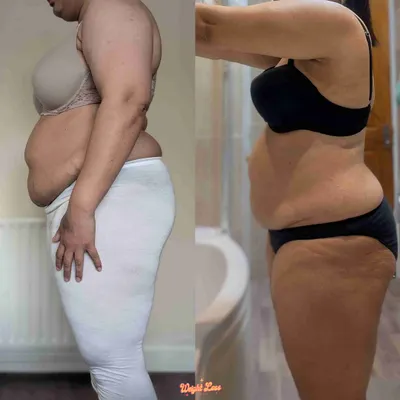Meet Gurpreet. She wanted to feel confident by 40 and is well on her way, 7.8kg down and counting. We worked on controlling sugar, building a consistent workout routine, and putting herself first.